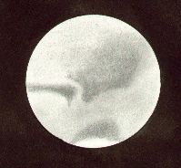 Mars, drawn by Ken Clarke, as viewed through a 10" F4.3 Reflector 308x,432x. w=14.4, seeing 3-5, at 00:00 UTC on November 4th, 1990